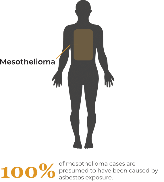 alabama mesothelioma lawyer